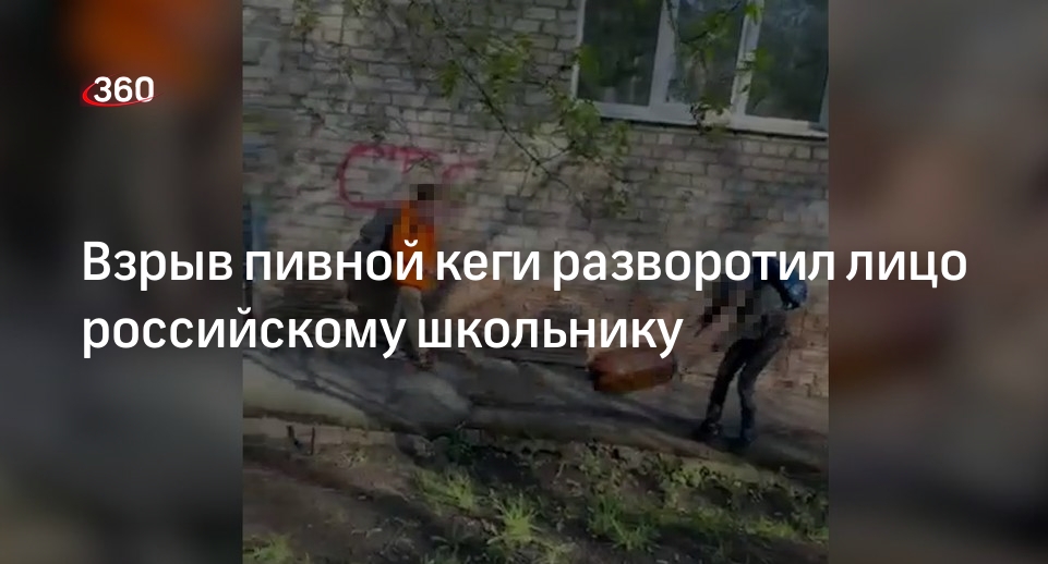 Лицо мальчика после взрыва кеги. Лицо мальчика после взрыва кеги